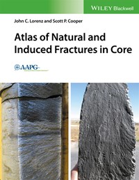 blog-learn-all-about-fractures-image1