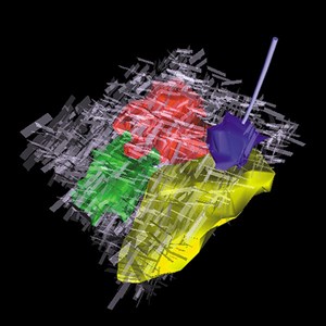 fracture-model-analysis-is-simple-fig4